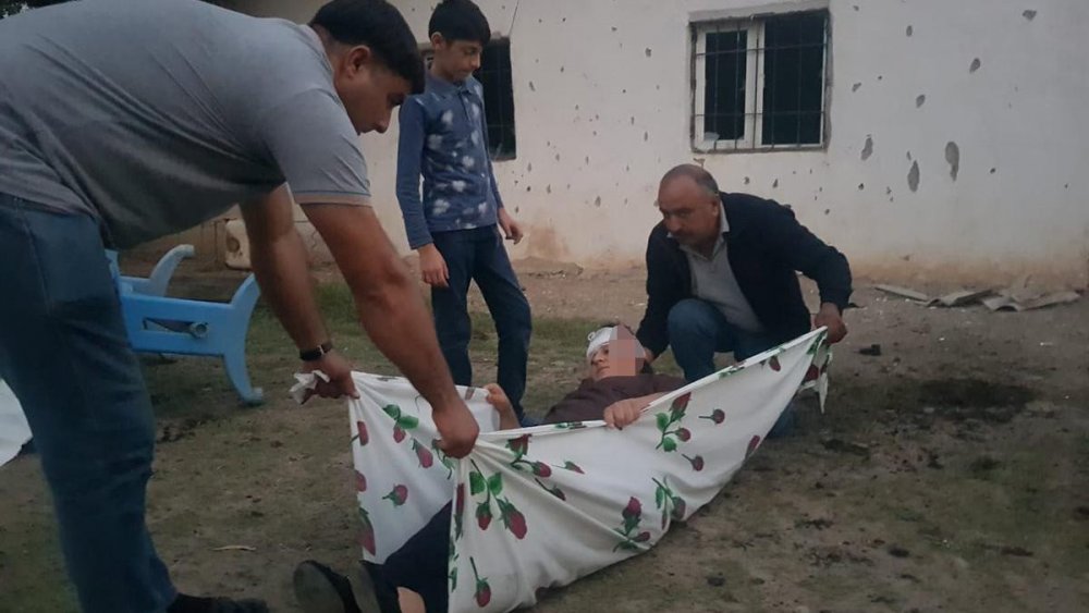 azerbaycan sivil yaralı